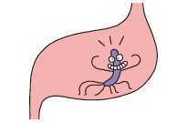 胃の中でも生きられるピロリ菌