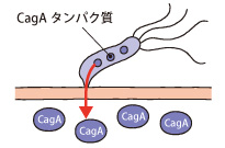 「CagA」毒素を作るピロリ菌