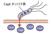 ピロリ菌